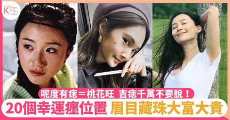 額頭痣 女|吉痣20個幸運位置＋辨別死痣